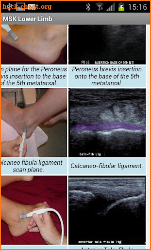 MSK ultrasound Lower Limb screenshot