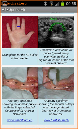 MSK ultrasound Upper Limb screenshot