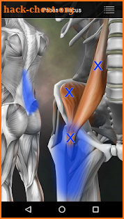 Muscle Trigger Point Anatomy screenshot