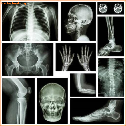 musculoskeletal x-ray interpretation screenshot