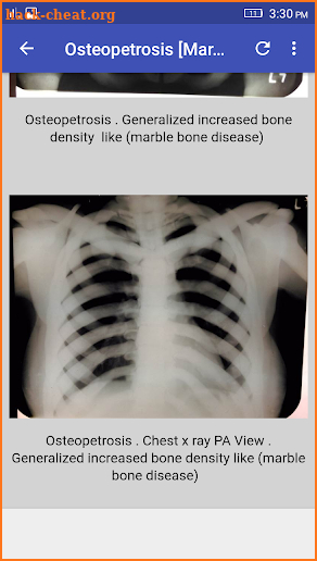 Musculoskeletal X- Rays Interpretation screenshot