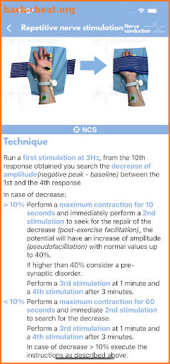 Nerve Conduction Studies screenshot