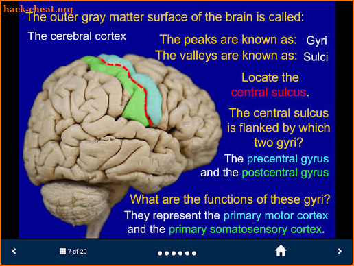 Neuroanatomy - SecondLook screenshot