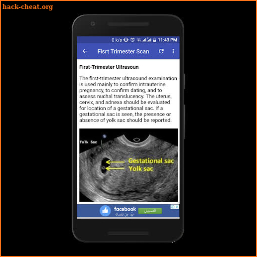Obstetrics & Gyenacology Ultrasound Guide screenshot