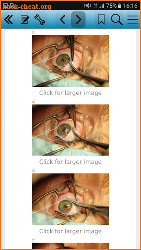 Ocular Motility Disorders, 4 screenshot