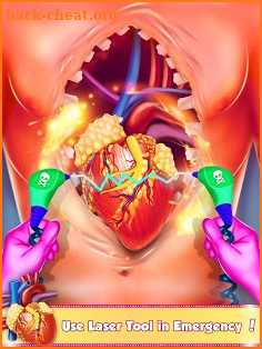 Open Heart Surgery: Er Emergency Doctor Games screenshot