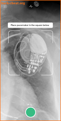 Pacemaker ID - Pacemakers and Defibrillators screenshot