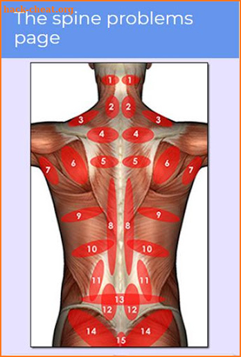 Pain symptom checker: muscle and tendon injuries screenshot