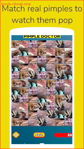 Pimple Doctor screenshot