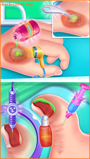 Pinky toe doctor screenshot
