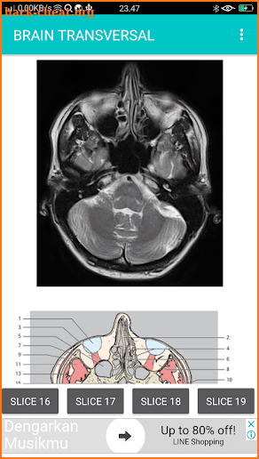 POCKET ATLAS MRI screenshot