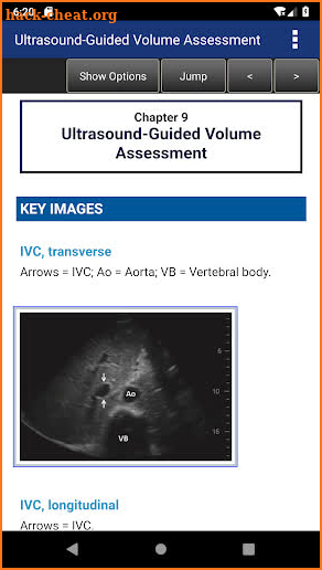 Pocket Guide to POCUS: Point-of-Care Ultrasound screenshot