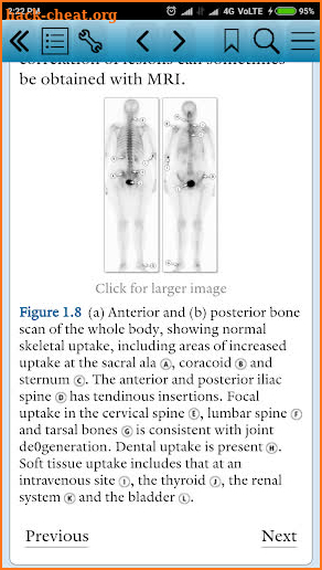 Pocket Tutor: Musculoskeletal Imaging screenshot