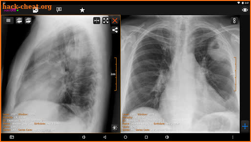 PORT-RAY: DICOM Viewer for Android screenshot