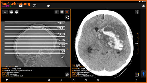 PORT-RAY: DICOM Viewer for Android screenshot