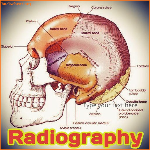 Positioning and Radiographic Anatomy of the Skull screenshot