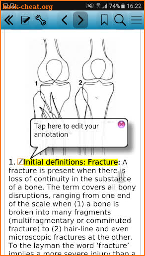 Practical Fracture Treatment 5 screenshot