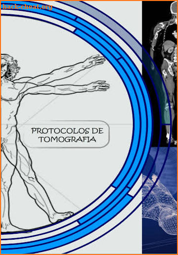 Protocolos Tomografía Helicoidal Multicorte screenshot