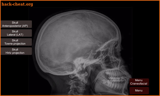 Radiographic Anatomy X-Ray screenshot