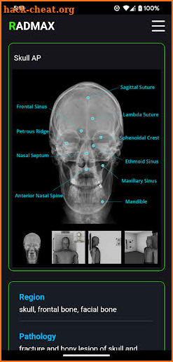 Radiography Positioning Guide screenshot
