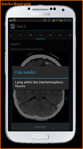 Radiological Anatomy For FRCR1 screenshot