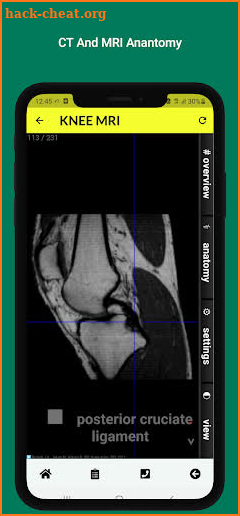 Radiology Anatomy CT And MRI screenshot