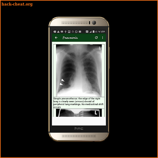Radiology Emergencies screenshot