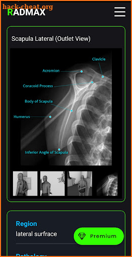 RadMax - Radiography Guide screenshot