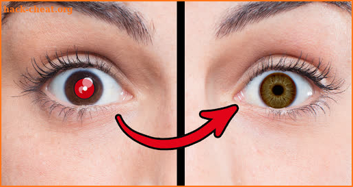 Red Eye Removal - Remove Red Eye screenshot