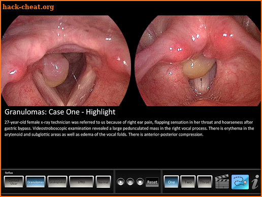 Reflux screenshot