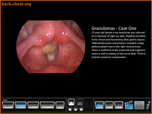 Reflux screenshot