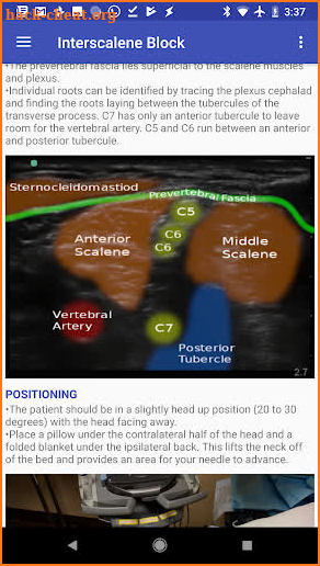 Regional Anesthesia Reference screenshot