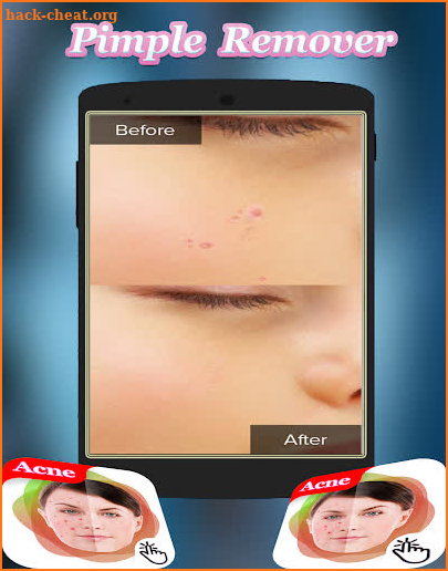 Remove pimples from photo -Acne And Pimple Remover screenshot