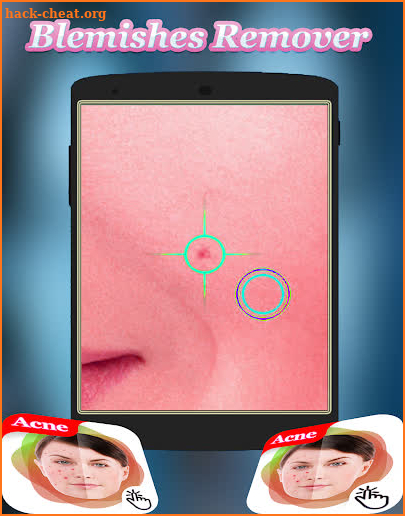 Remove pimples from photo -Acne And Pimple Remover screenshot