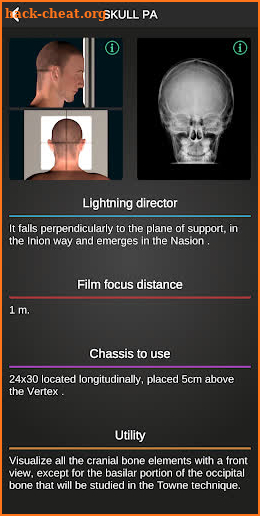 RX - Radiographic Positioning screenshot