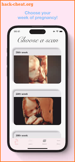 ScanBaby learn baby ultrasound screenshot