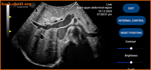 Scanbooster Ultrasound Simulator screenshot