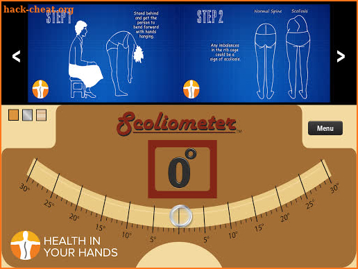 Scoliometer HD screenshot