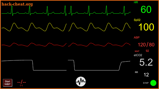 Simpl - Simulated Patient Monitor screenshot