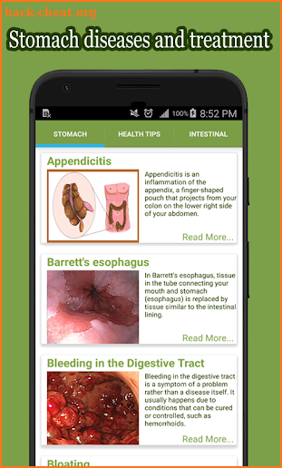 Stomach Diseases and Treatment screenshot