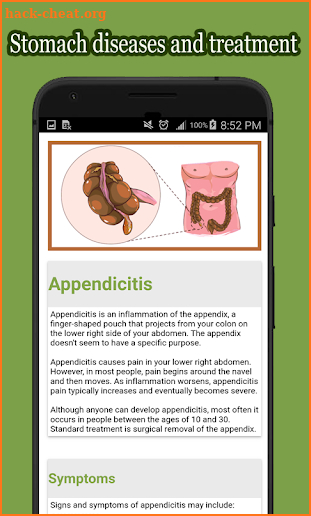 Stomach Diseases and Treatment screenshot