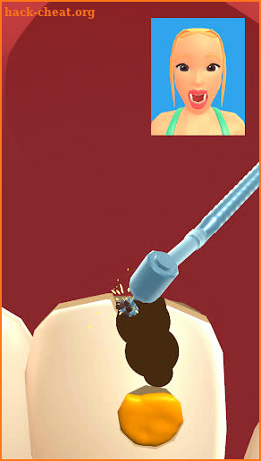 Teeth Digger 3D screenshot