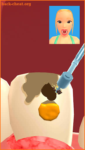 Teeth Digger 3D screenshot