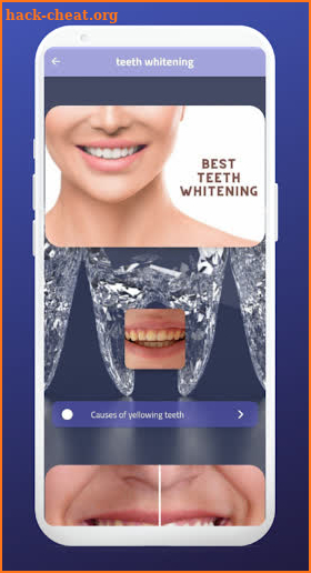 teeth whitening screenshot