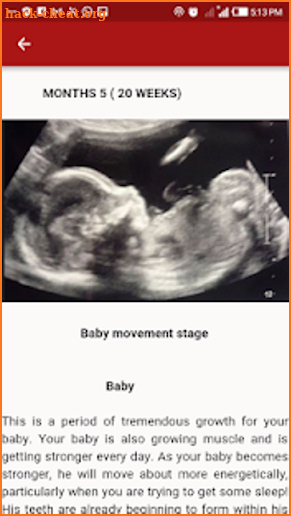 Ultrasound for pregnancy screenshot