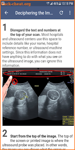 Ultrasound Guide screenshot