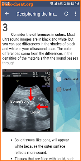 Ultrasound Guide screenshot