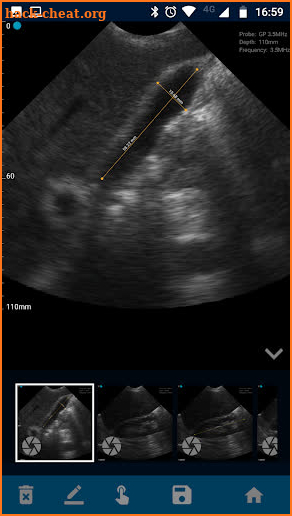 VistaScan Ultrasound App screenshot
