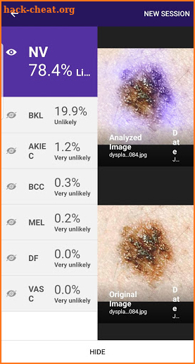 Visus: Skin Cancer Detection screenshot