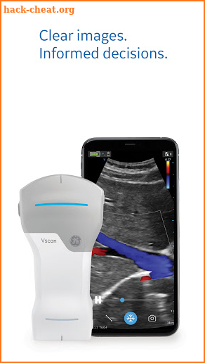 Vscan Air Wireless Ultrasound screenshot